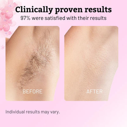 Eloura Cyperus Rotundus Oil for Natural Permanent Hair Reduction