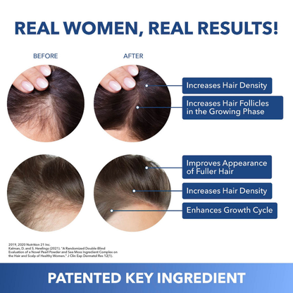 You lost the weight, don't lose your hair. Try Eloura HairRevive™ Roll on System, specifically designed for GLP-1, Mounjaro users.