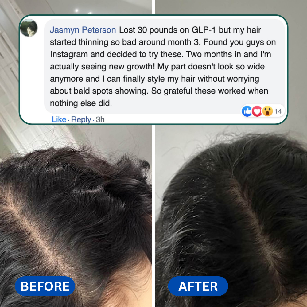 You lost the weight, don't lose your hair. Try Eloura HairRevive™ Roll on System, specifically designed for GLP-1, Mounjaro users.
