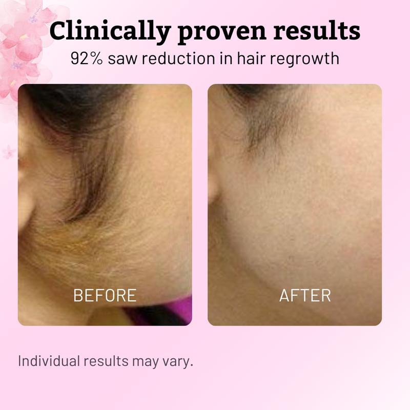 Eloura Cyperus Rotundus Oil for Natural Permanent Hair Reduction